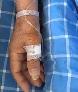 女生高清手背输液视频